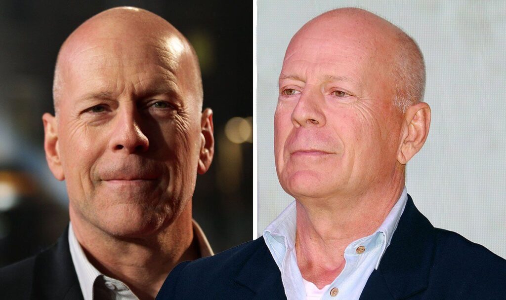 Bruce Willis Health