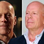 Bruce Willis Health